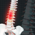 spine Wrongful Death Caused by Minnesota Truck Accident