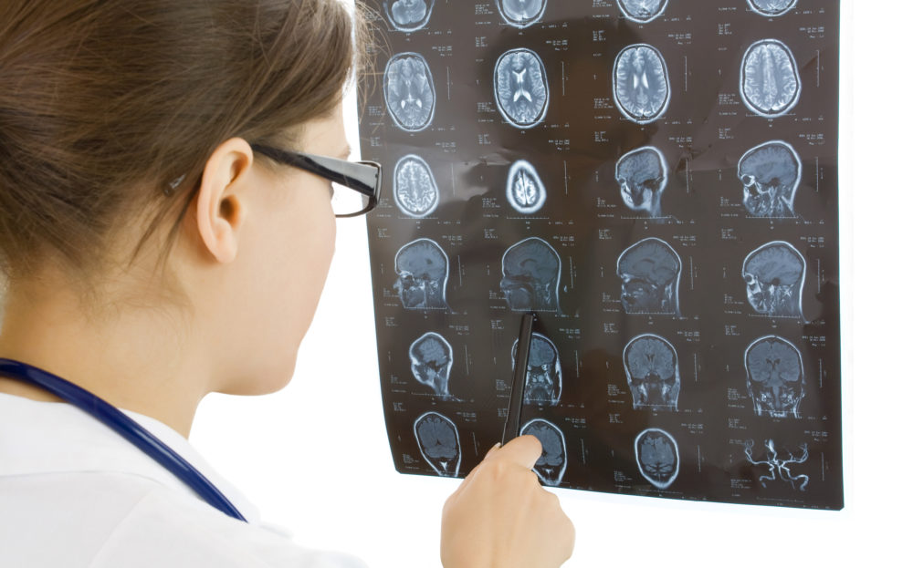 Minnesota Traumatic Brain Injury Caused by Slip and Fall